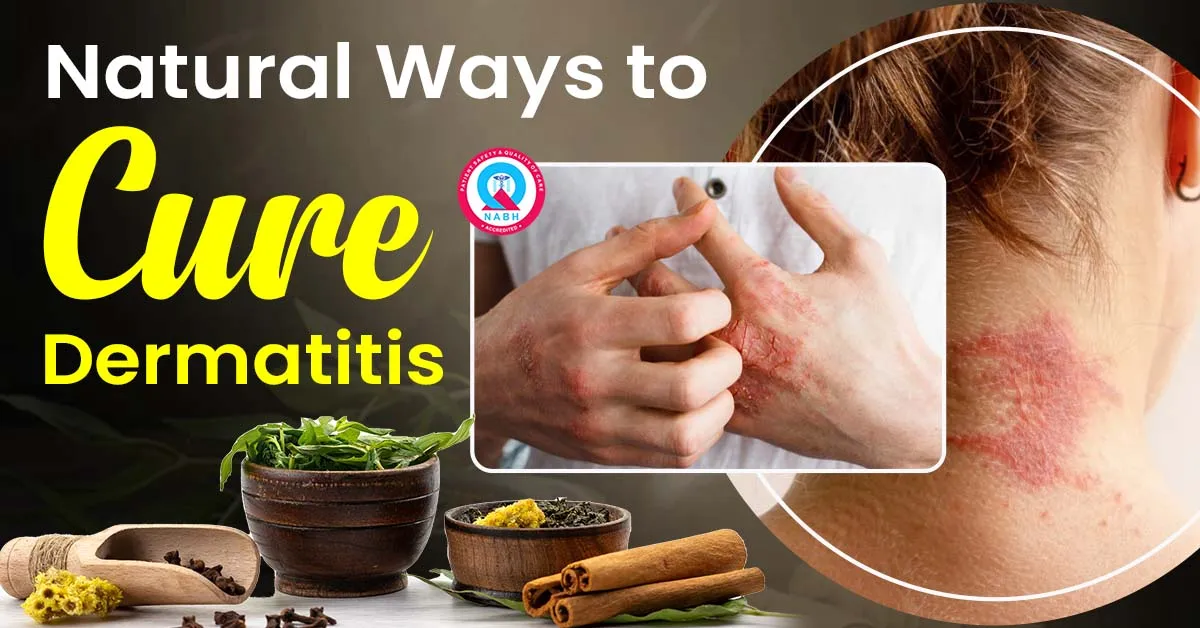 natural-ways-to-cure-dermatitis